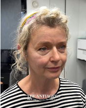 Signature Antigravity Lift™